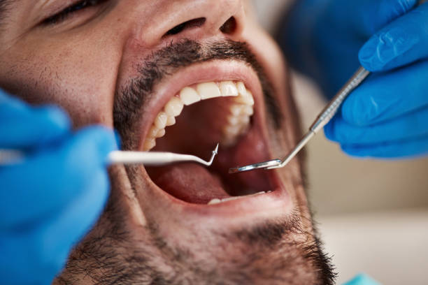 Best Broken or Chipped Tooth Repair in Hallowell, ME